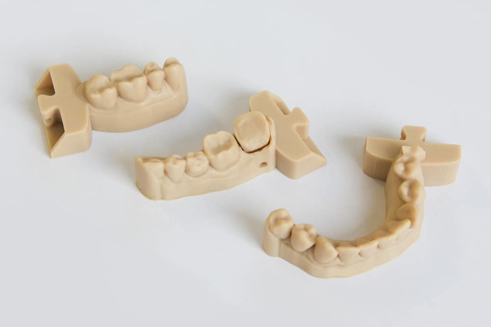 Upper and lower jaws dental bridge printed on a Stereolithography 3D printer